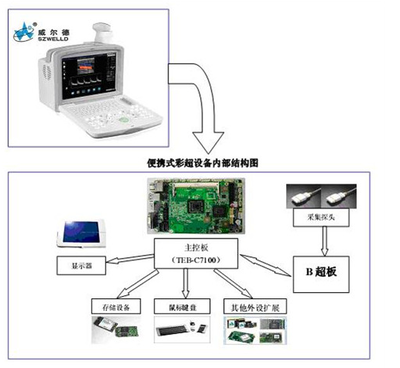 工控自动化应用方案:COM-E模块在医疗B超设备中的应用